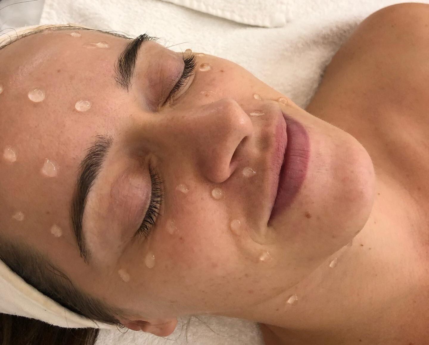 facial
